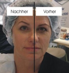 skincoach